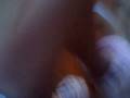 lauren attacks...