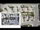 Terrain Matching using Skilligent Robot Vision System (Demo)