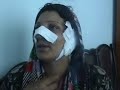 While Valentine's Day was being observed around the world, in Afghanistan, husband of Nafisa, cut off her ear and nose and put hot water on her small child. The inhuman act was carried in Herat Province in the Western Afghanistan on Feb.14, 2008.گوش و بینی نفیسه از سوی شوهرش بریده شدمسوولین کمیسیون مستقل حقوق بشر در ولایت هرات با تائید این خبر می گویند که شوهر معتاد نفیسه بعد از بریدن گوش و بینی وی فرار کرده است. نفیسه در حالیکه همراه با کودکش در شفاخانه بستری است داستان هولناکش را حکایت میکند. وی اظهار داشت که پاهای دختر خوردسالش نیز از سوی شوهرش بوسیله آب داغ سوخته است. وی از مرارت های زندگی با شوهر حیوان صفتش میگوید که در جریان دوازده سال زندگی مشترک با وی بدترین شرایط را سپری کرده است.  وی از دولت و نهاد های مدافع از حقوق زنان خواست تا زمینه طلاق وی از شوهرش را فراهم کنند. چند ماه گذشته  نیز یک گوش و بینی یک زن در ولایت غور بوسیله شوهر بی‌غیرتش بریده شده بود. این دو واقعه جگرخراش از میان صدها واقعه خشونت علیه زنان در کشور است که به مطبوعات کشانیده میشوند. و خبر در حالی پخش شد  که از روز جهانی حقوق بشر در در ولایت هرات از سوی کمیسیون مستقل حقوق بشر تجلیل صورت گرفت و بصورت منزجرکننده وضعیت حقوق زنان بهتر از قبل خوانده شد و اعلام گردید که خشونت علیه زنان نسبت به گذشته پنجاه فیصد کاهش یافته است!متاسفانه در کشور جنگسالار زده و مافیایی، عاملان این فجایع با مصونیت کامل بسر برده و به پنجه قانون سپرده نمیشوند چون حاکمان فاسد خود منشای خشونت های موحش علیه زنان هستند.به تاریخ ۳۰ جنوری سال جاری میلادی، زن ۲۵ ساله به نام پښتنه  با دیدن بی‌توجهی و بی‌بازخواستی محکمه در دوسیه خشونت شوهرش علیه وی، در برابر ستره محکمه ولایت لغمان دست به خود سوزی زد.