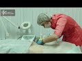 Липосакция без операции в клинике "Космет"