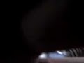 Reportaje A Un Drogadicto (Complice De Una Camara Oculta)