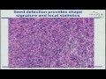 TCGA Computational Histopathology Pipeline Reveals Subtypes... - Bahram Parvin