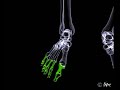 Foot Anatomy - Part 2.mpg