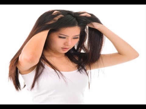 how to kill dandruff fungus