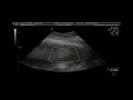 mon echographie