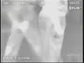 XRAY yakalar!!! XRAY yakalar!!!