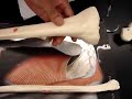 Humananatomy361 Tibia/Fibula