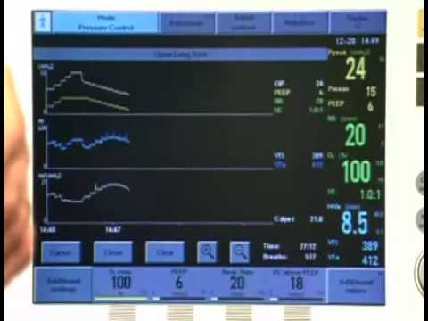 how to perform lung recruitment maneuver