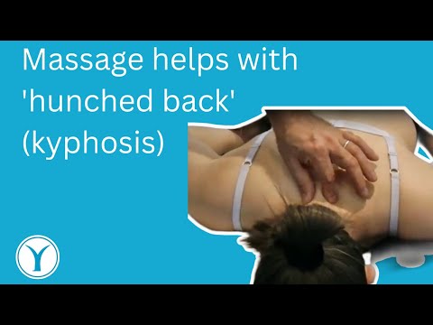 how to cure kyphotic spine