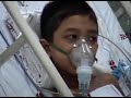 Carlo Pectus Excavatum 2 - @ Recovery Room