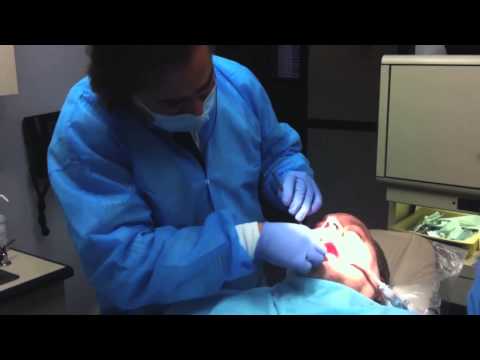 how to cure oral cancer