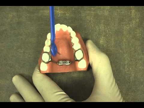 how to turn an expander