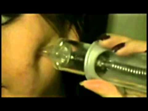 Remove acne & deep blackhead by Dermatologist