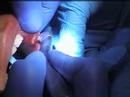 Laser Dentist Laser Dentist