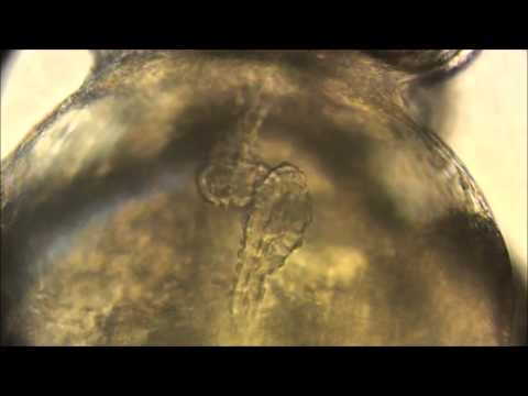 eLife : Mitochondrial Ca2+ uptake by the voltage-dependent anion channel 2 regulates cardiac…