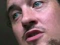 what is klinefelter syndrome? Klinefelter syndrome