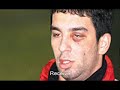 Arda Turan Kaza Gecirdi. Resim