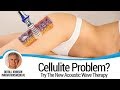 Acoustic Wave Therapy at Innovations MedSpa