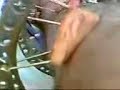 Yoni gets pin taken out of his leg hardware Yoni gets pin taken out of his leg hardware