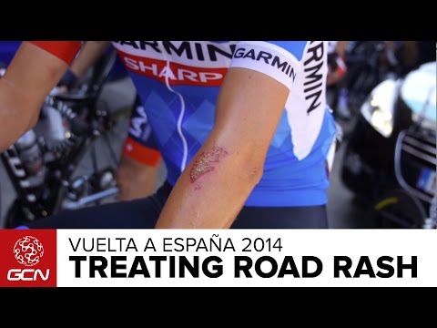 how to treat rashes
