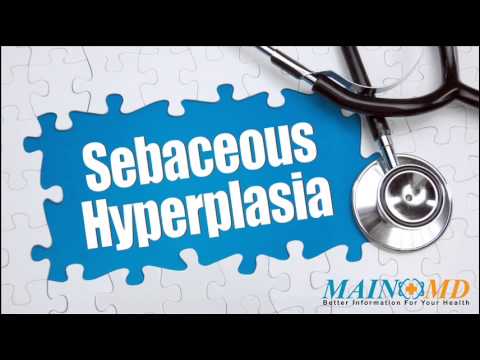 how to get rid of sebaceous hyperplasia