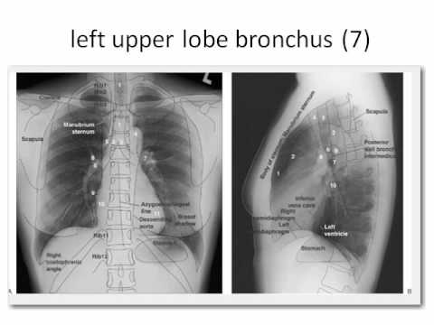how to treat low cvp