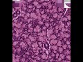 Shotgun Histology Sublingual Gland