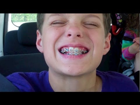 caleb - Big day today! Caleb gets braces. Send us mail to: Bratayley 5635 Main St. Suite A PMB 256 Zachary, LA 70791 Our Official Links: Follow us on Twitter @Bratay...