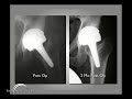 What is the BMHR? Lecture Video Part 3 What is the BMHR? Lecture Video Part 3