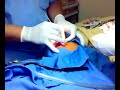 Nose Trimming Nose Trimming