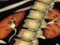 Cuerpo humano 3D
