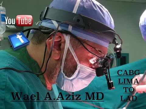 how to perform heart surgery