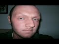 Leukaemia/Bone Marrow Transplant 12: ECP