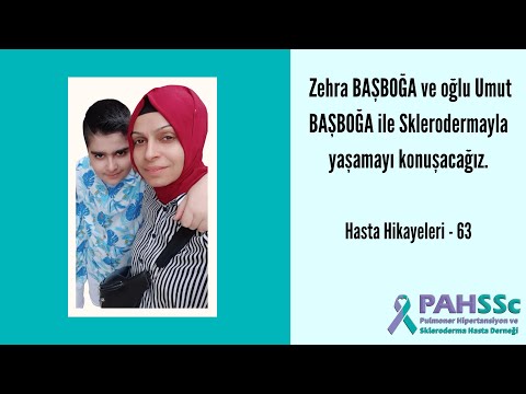 Hasta Hikayeleri - Zehra BAŞBOĞA ve oğlu Umut BAŞBOĞA ile Sklerodermayla Yaşamak - 63 - 2022.06.14