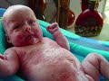 Presley - Battle with Neonatal Lupus