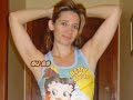 MEU PRIMEIRO ANO AP�S A CIRURGIA BARIATRICA (GASTROPLASTIA)