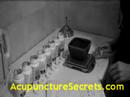 Acupuncture Courses at http://www.acupuncturesecrets.com/