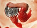 ABORTO!!! CONALEP TECATE ABORTO!!! CONALEP TECATE