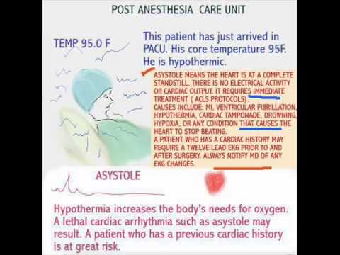 how to treat asystole