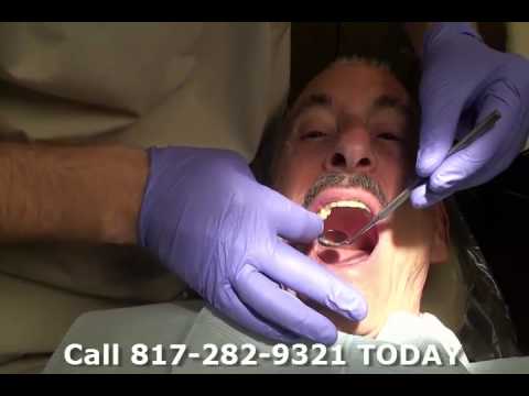 how to whiten permanent bridges