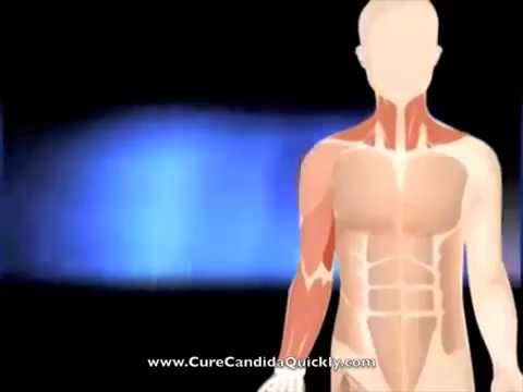 how to cure male yeast infection