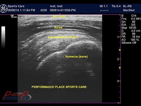 how to read ultrasound