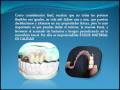 PROTESIS DENTAL FLEXIBLES