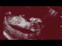 Shining a Light on Infant Mortality