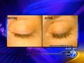 WLS - ABC 7 in Chicago - #2