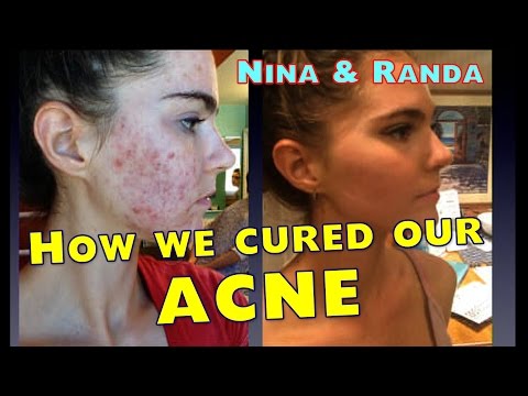 how to eat to get rid of acne