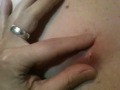 Cyst Part 1...