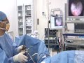 TURP-Prostate-Operat