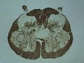 Sacral Cord Part 1