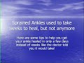 Sprained Ankles can be healed in less than a week
